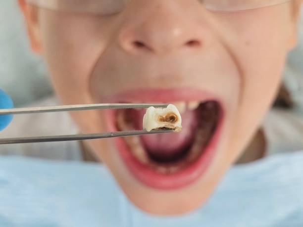 Best Weekend Emergency Dentist in Fayette, LA